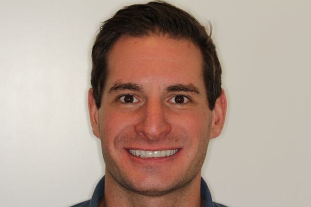 Veneers: Case 1: Jeff - After