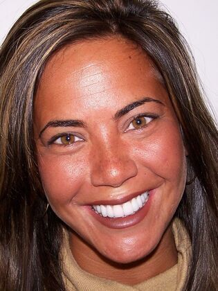 Veneers: Case 8: Michelle - After