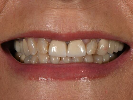 Full Smile Transformations Case 8 - Before
