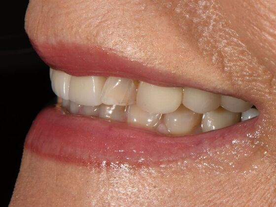 Full Smile Transformations: Case 8 - Before