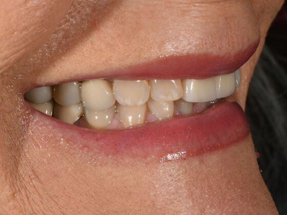 Full Smile Transformations: Case 8 - Before