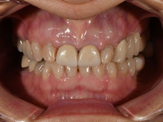 Full Smile Transformations: Case 8 - Before