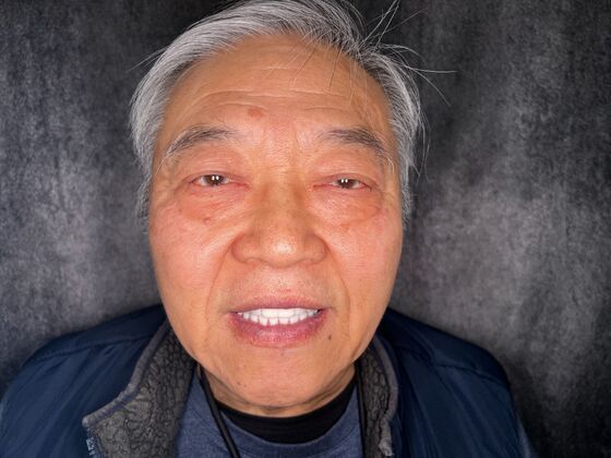 All on 4 Dental Implants: Case 22 - After