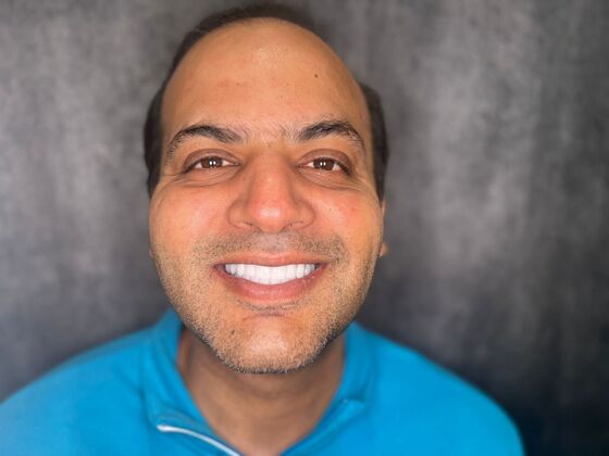 All on 4 Dental Implants: Case 24 - After