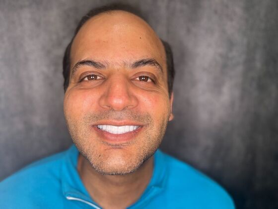 All on 4 Dental Implants: Case 24 - After