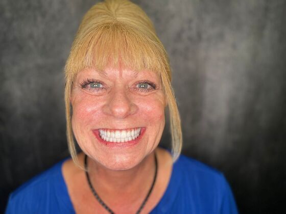 All on 4 Dental Implants: Case 25 - After
