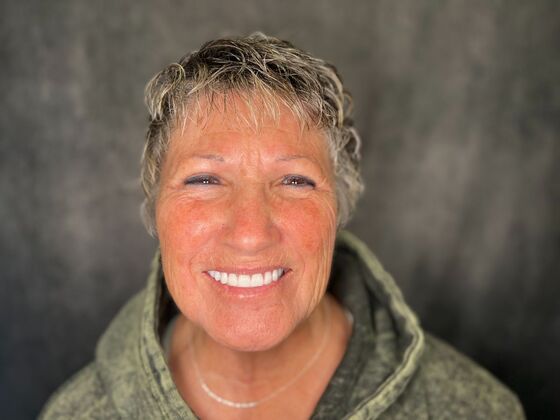 All on 4 Dental Implants: Case 26 - After