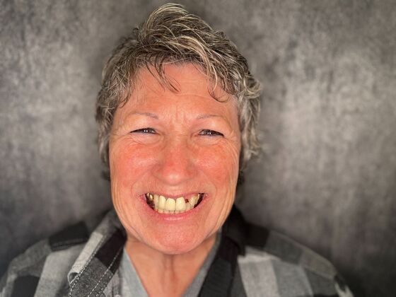 All on 4 Dental Implants: Case 26 - Before
