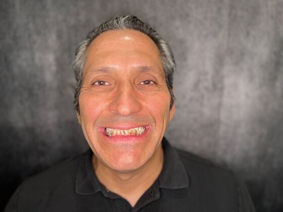 All on 4 Dental Implants: Case 27 - Before