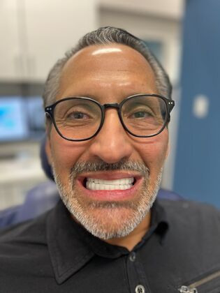 All on 4 Dental Implants: Case 27 - After