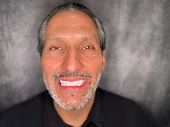 All on 4 Dental Implants: Case 27 - After