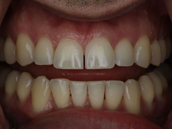 Gap Closure Case 7 - Before