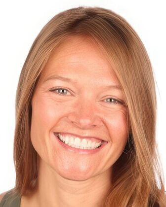No-Prep Veneers Cases