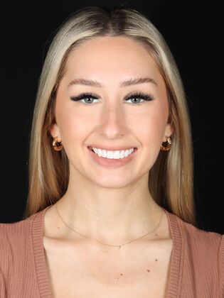 Veneers Jess - After