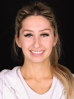 Veneers Jess - Before