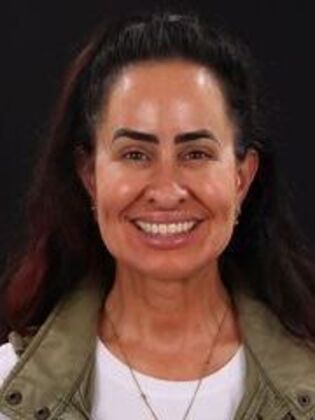 Veneers Katie - Before