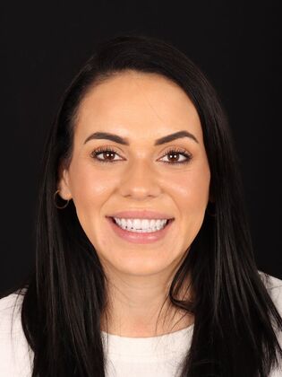 No-Prep Veneers Kayla - After