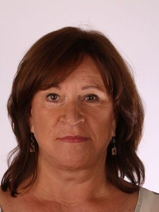 Dental Implants: Sherry - After