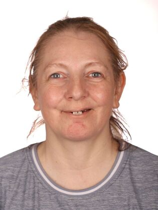 Dental Implants Heather - Before