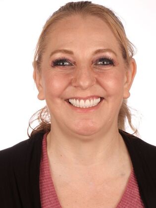 Dental Implants Heather - After