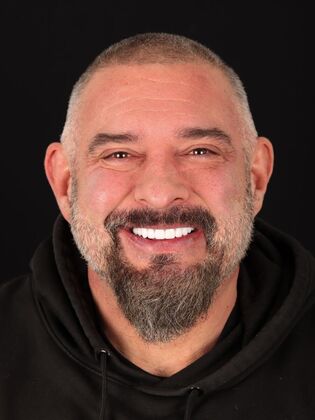 Full Mouth Reconstruction Andy - After