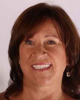 Dental Implants Cases