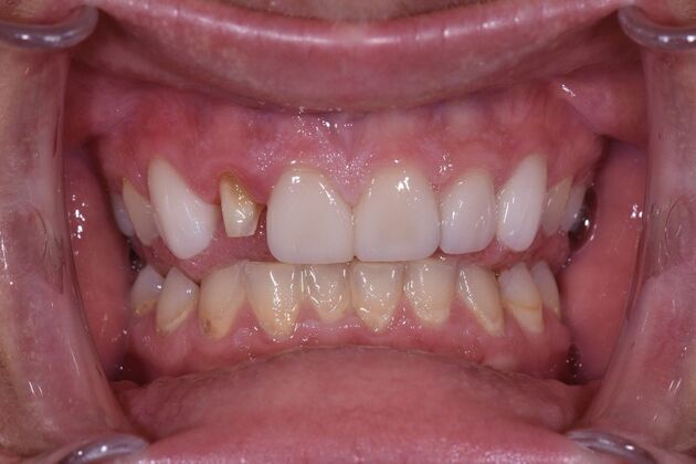 Dr. Greys Work Katilin Parker  - Before