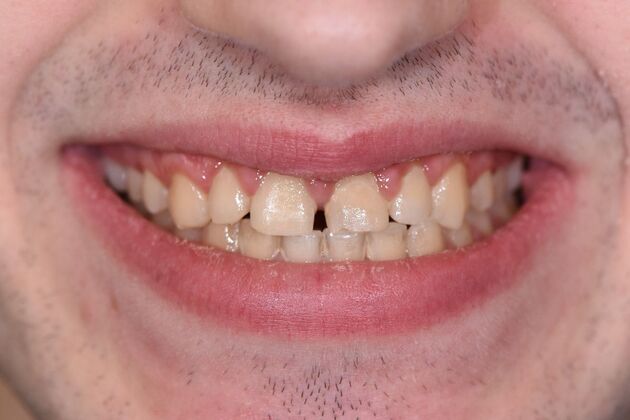 Dr. Greys Work Nicholas Sciarabba  - Before