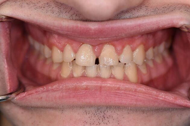 Dr. Greys Work: Nicholas Sciarabba - Before