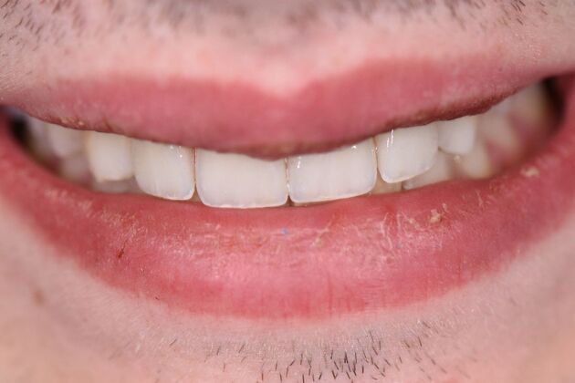 Dr. Greys Work Nicholas Sciarabba  - After