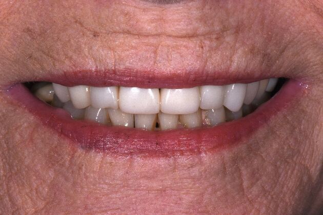 Dr. Greys Work Sheila Lyon  - After
