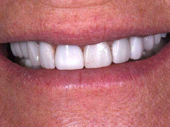 Dr. Greys Work Sherry Collier - After