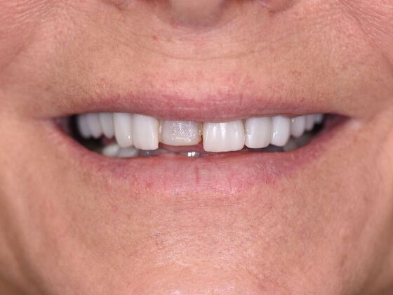 Dr. Greys Work Sherry Collier - Before