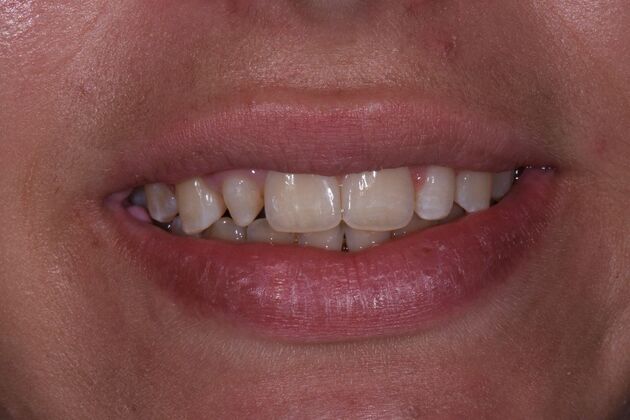 Dr. Woods Work  Olivia Rhodes  - Before