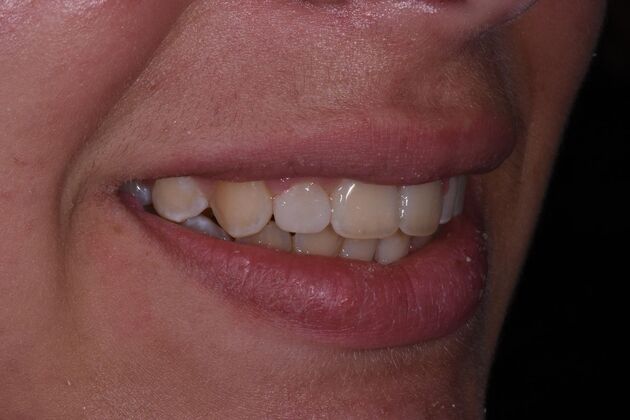 Dr. Woods Work : Olivia Rhodes - After