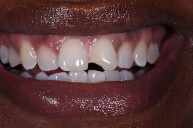 Dr. Goochs work Case 1 - Before