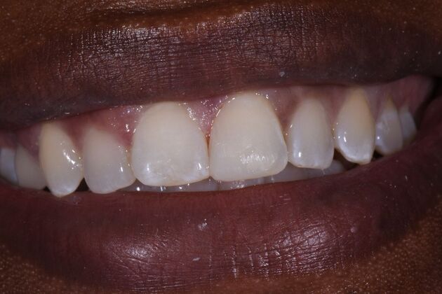 Dr. Goochs work Case 1 - After