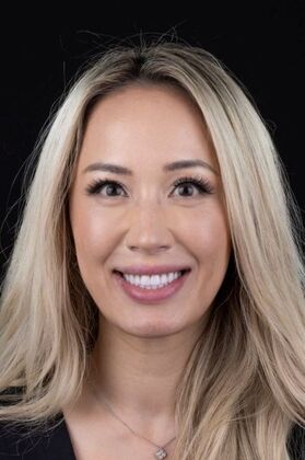 Smile Makeover & Veneers: Natalie - After