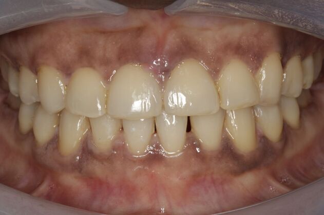 Orthodontics Gifty - After