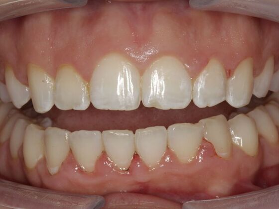 Orthodontics Michelle  - After