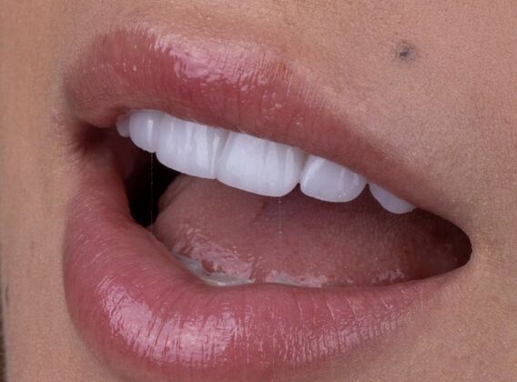 Smile Makeover & Veneers Margaret