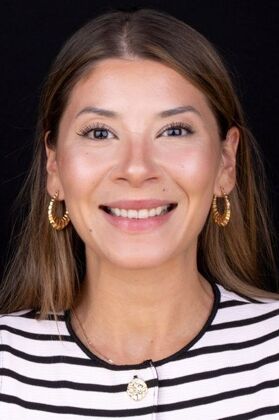 Smile Makeover & Veneers: Margaret - Before