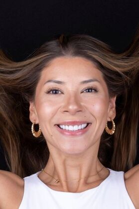 Smile Makeover & Veneers: Margaret - After