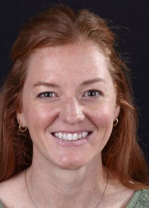 Smile Makeover & Veneers: Maren - Before