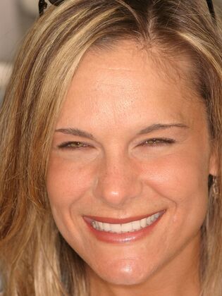 Porcelain Veneers: Case 8: Bucks County PA