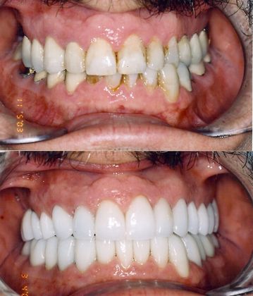 Cosmetic Makeovers Case 2 - Before