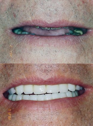 Cosmetic Makeovers Case 7 - After