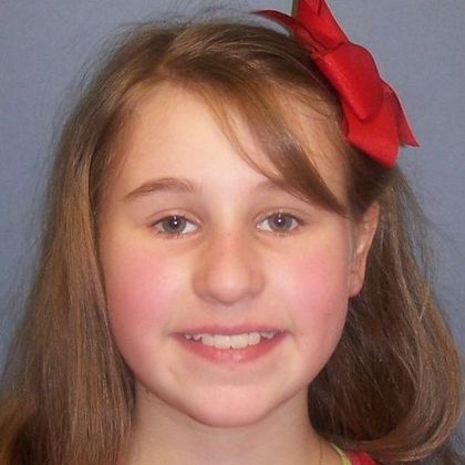 Children Smiles: Open Bite and Narrow Arch - After