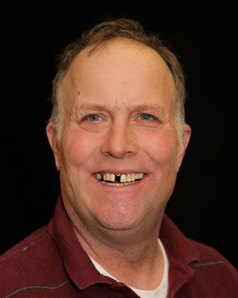 Restorative Dentistry Case 2 - Before