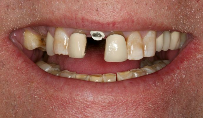 Restorative Dentistry: Case 2 - Before